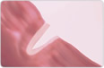 ThermoStapler&reg; 5